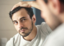 Sos cheveux homme : nos solutions anti-chutes